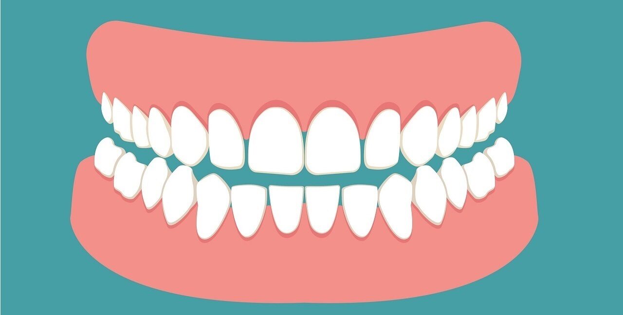 Odontotecnici:  pronti i materiali per la corretta applicazione del Regolamento comunitario 2017/745